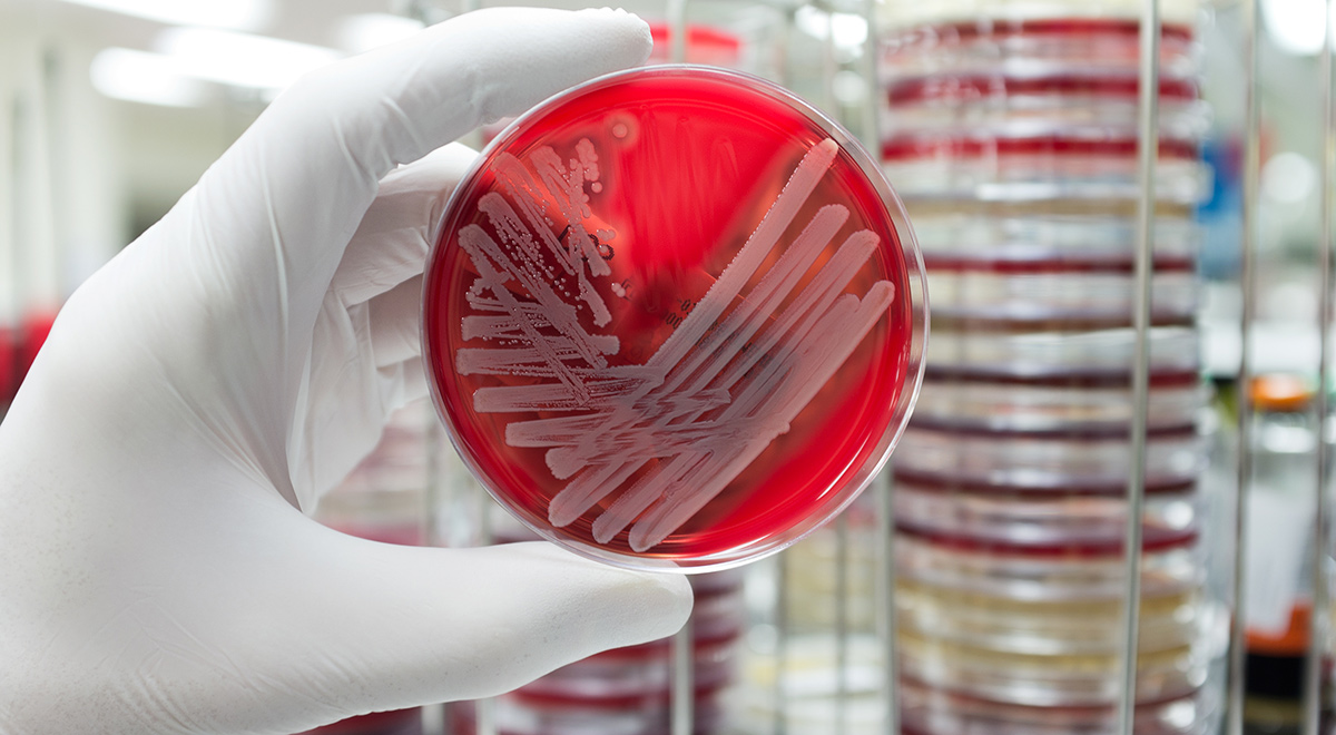 A Drug-Resistant Superbug May Be Far More Common Than Previously Thought