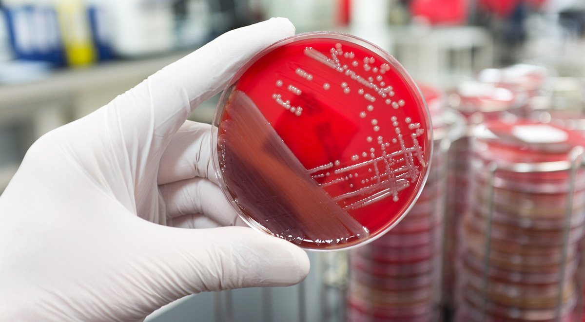 Good News For The Weekend: Scientists Are Figuring Out A Way to Combat “Superbugs”