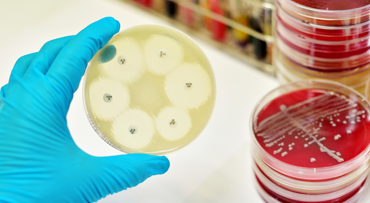 Starving “Superbugs” May Offer a Solution to Antibiotic Resistance