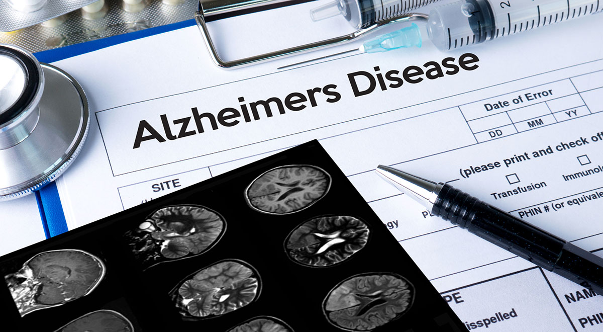 Triple-Action Diabetes Medication Promises to Reverse Alzheimer’s Disease, New Study Finds